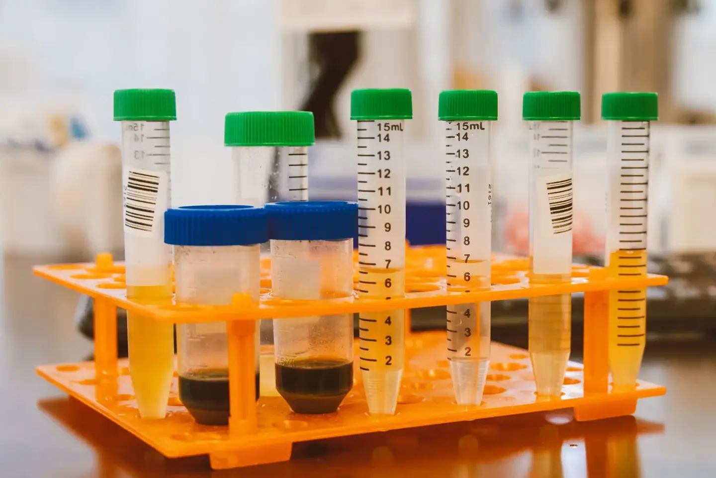 Samples being processed in the laboratory