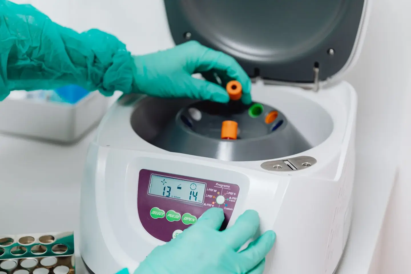 Diagnostic samples ready for analysis