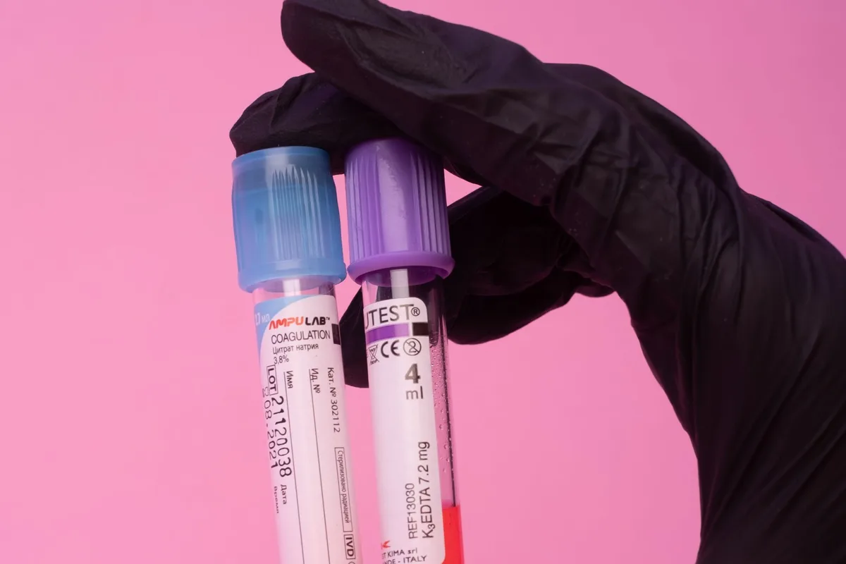 Two blood sample tubes held up in a gloved hand for hormone testing