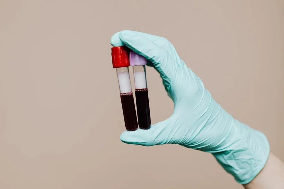 Two blood sample tubes with the plasma separated above the red cells