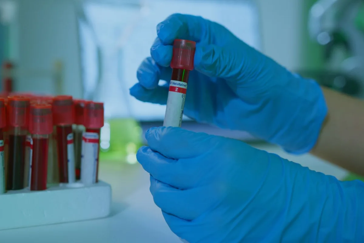A gloved hand holding a blood sample tube in the laboratory
