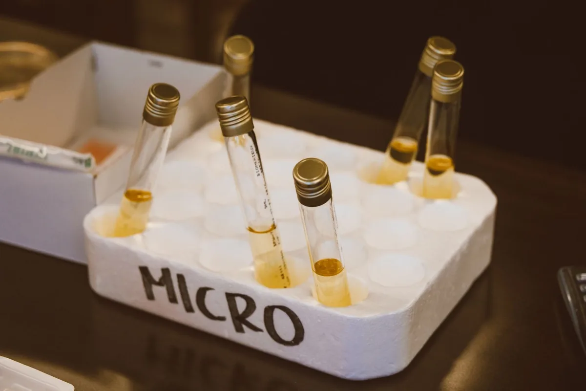 Urine samples in test tubes, ready for laboratory analysis